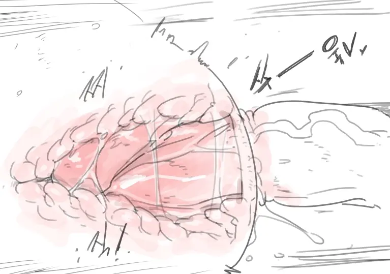 넷캔
